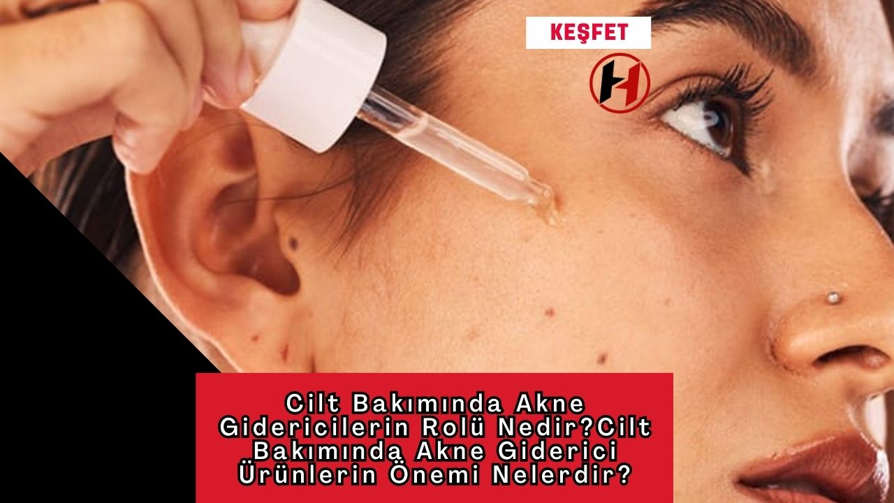 Cilt Bakımında Akne Gidericilerin Rolü Nedir?Cilt Bakımında Akne Giderici Ürünlerin Önemi Nelerdir?